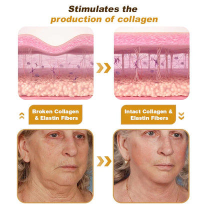 Illustration of skin with collagen fibers and before/after comparison of a woman's face.